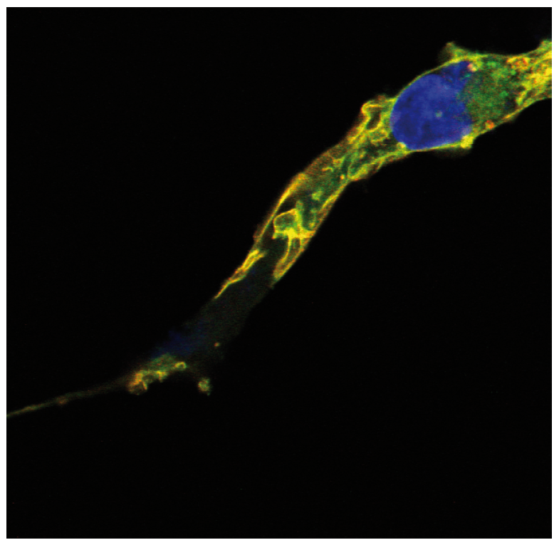 R-RAS2 Antibody