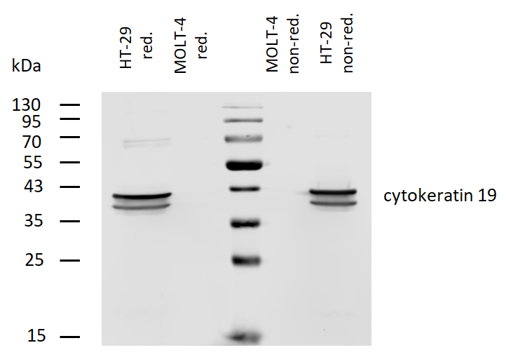 Cytokeratin 19 Antibody (Biotin)