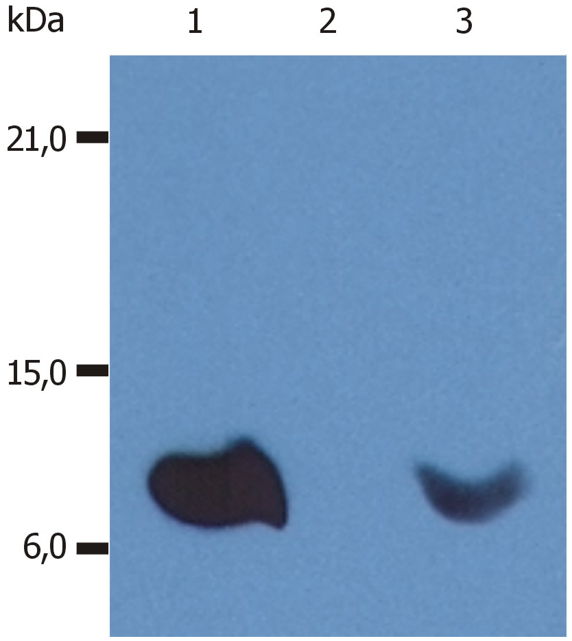 beta2-Microglobulin Antibody
