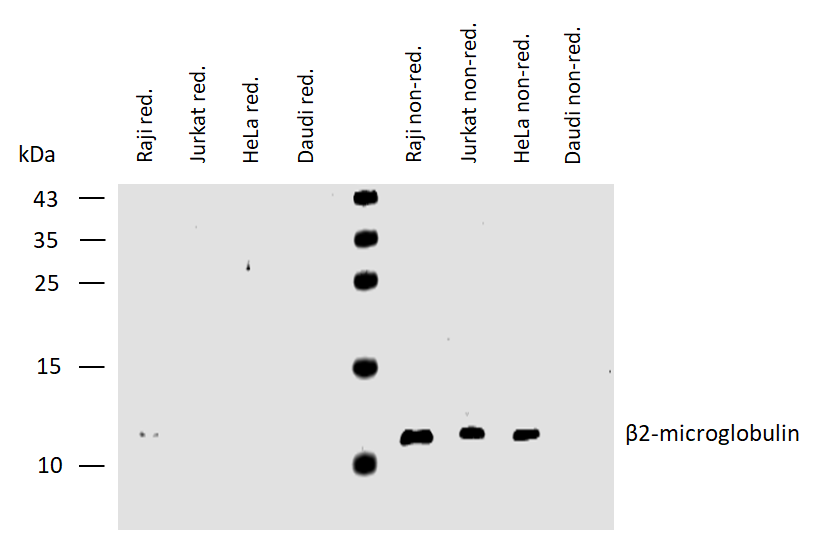 beta2-Microglobulin Antibody