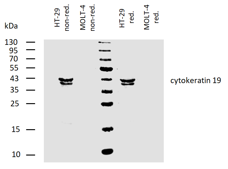 Cytokeratin 19 Antibody