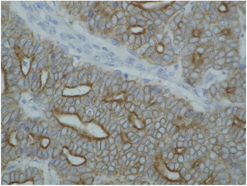 Cytokeratins Antibody