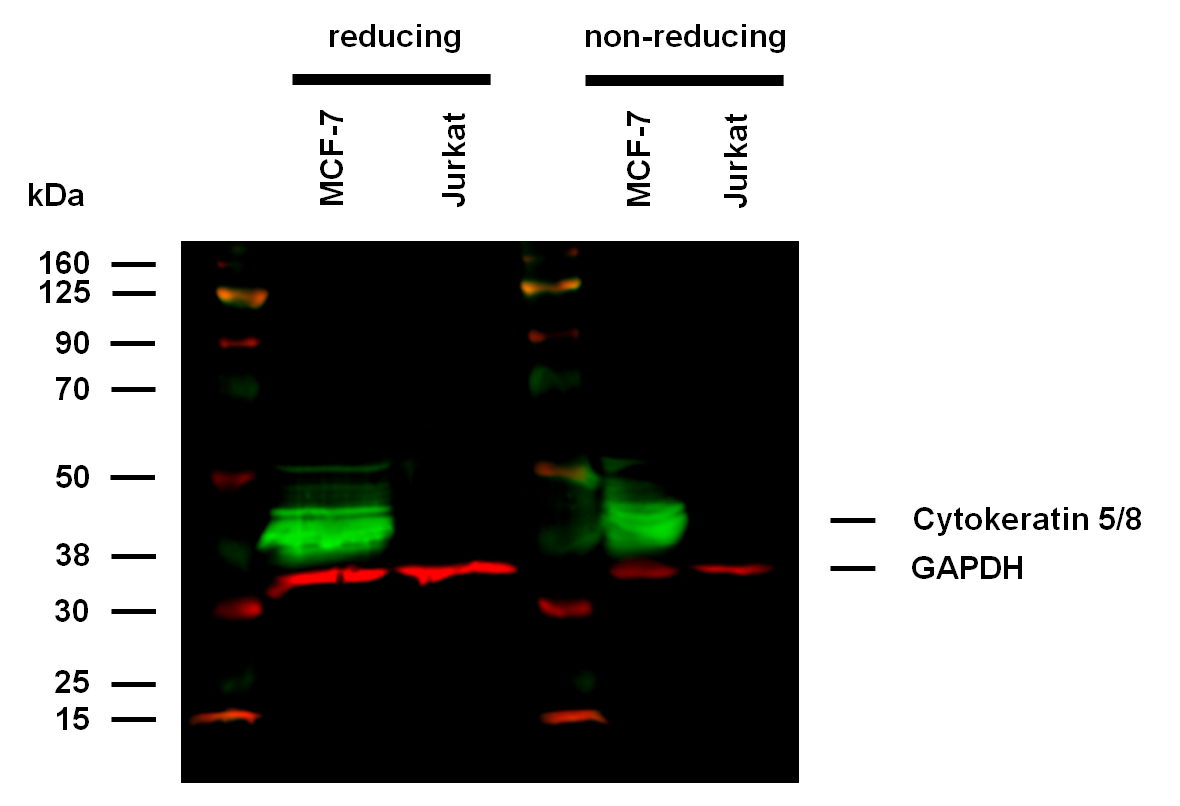 Cytokeratins Antibody