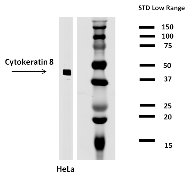 Cytokeratin 8 Antibody