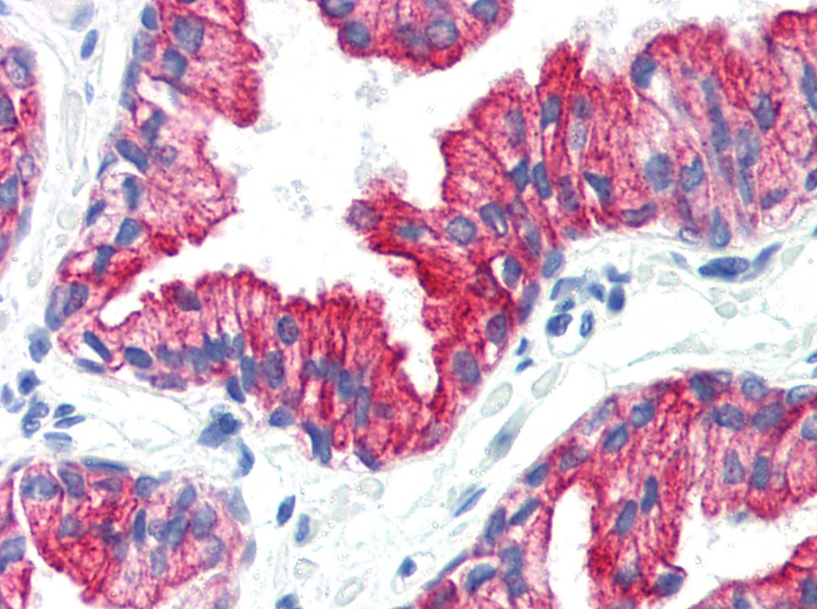 Cytokeratin 8 Antibody