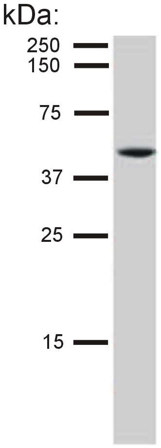 Cytokeratin 8 Antibody