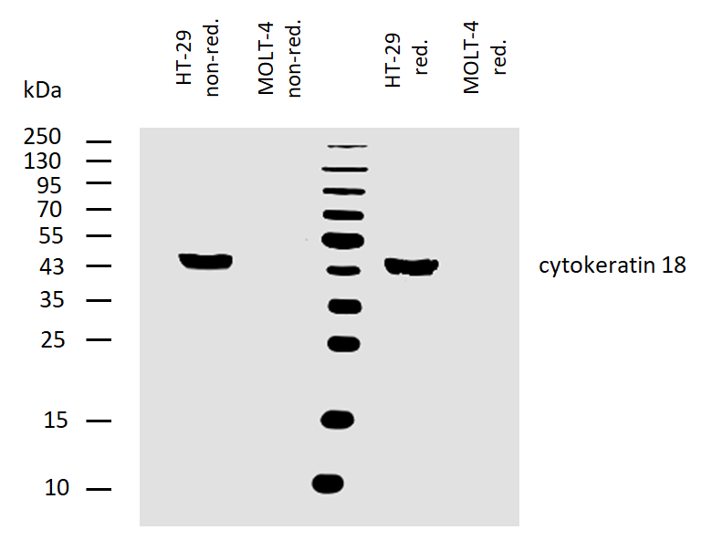 Cytokeratin 18 Antibody