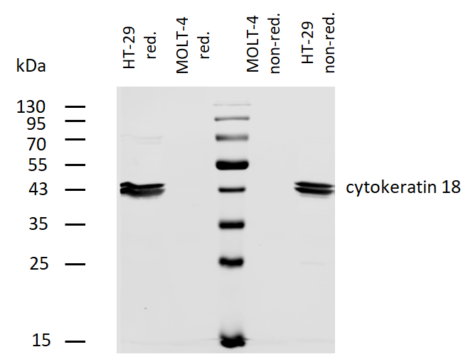 Cytokeratin 18 Antibody (Biotin)