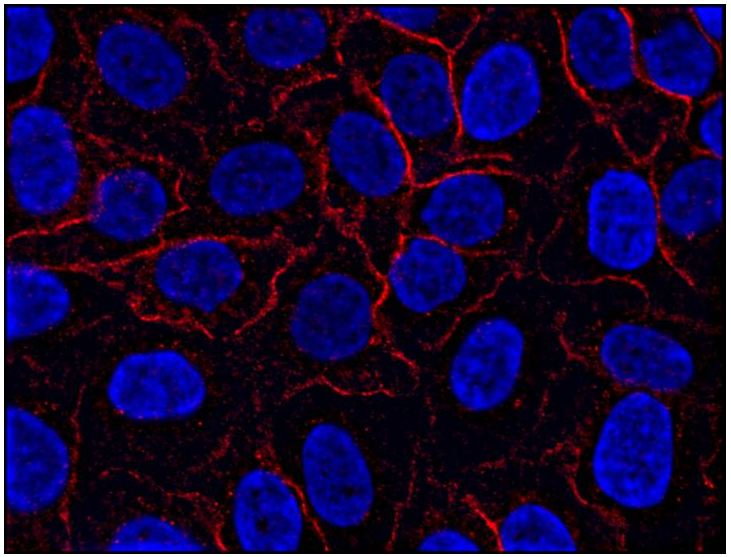 AHNAK1 Antibody