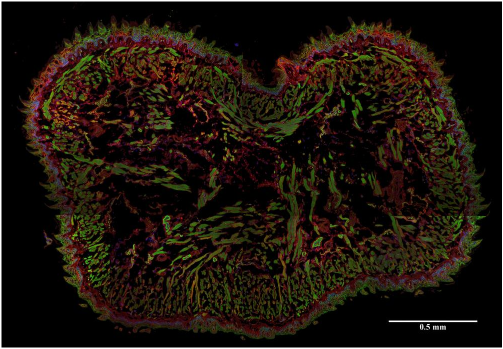 AHNAK1 Antibody