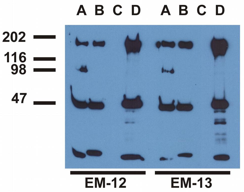 EGFR (pY992) Antibody