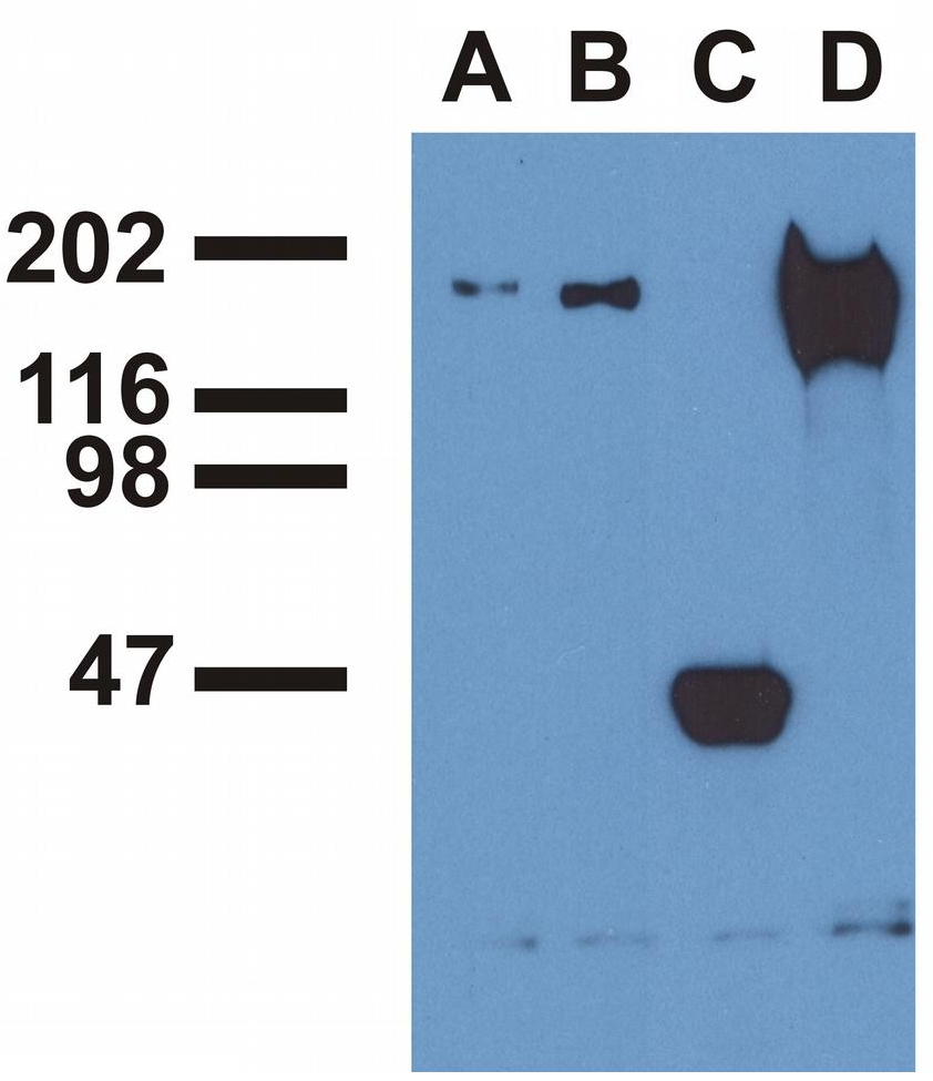 EGFR (pY992) Antibody