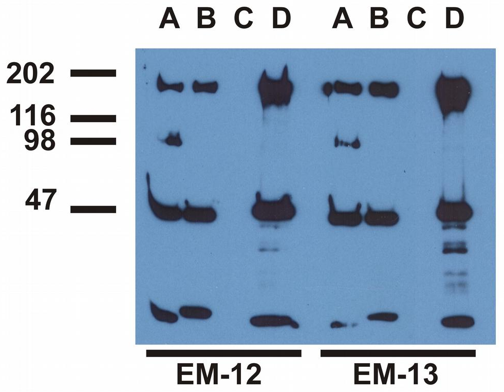 EGFR (pY1173) Antibody