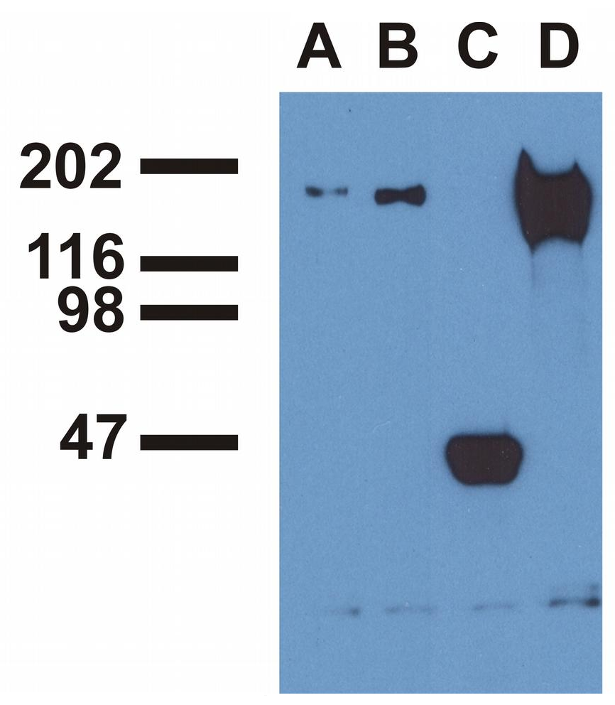 EGFR (pY1173) Antibody