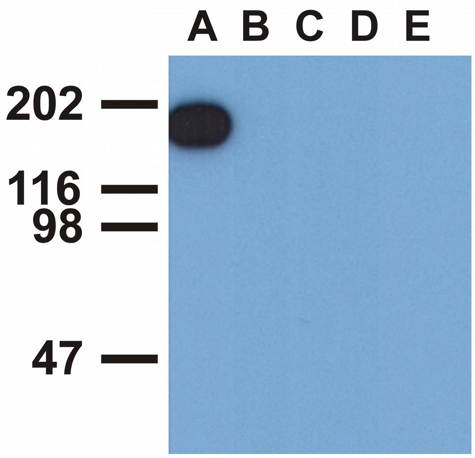 EGFR (pY1173) Antibody