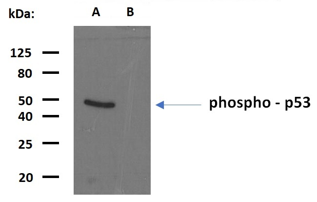 p53 (pS392) Antibody