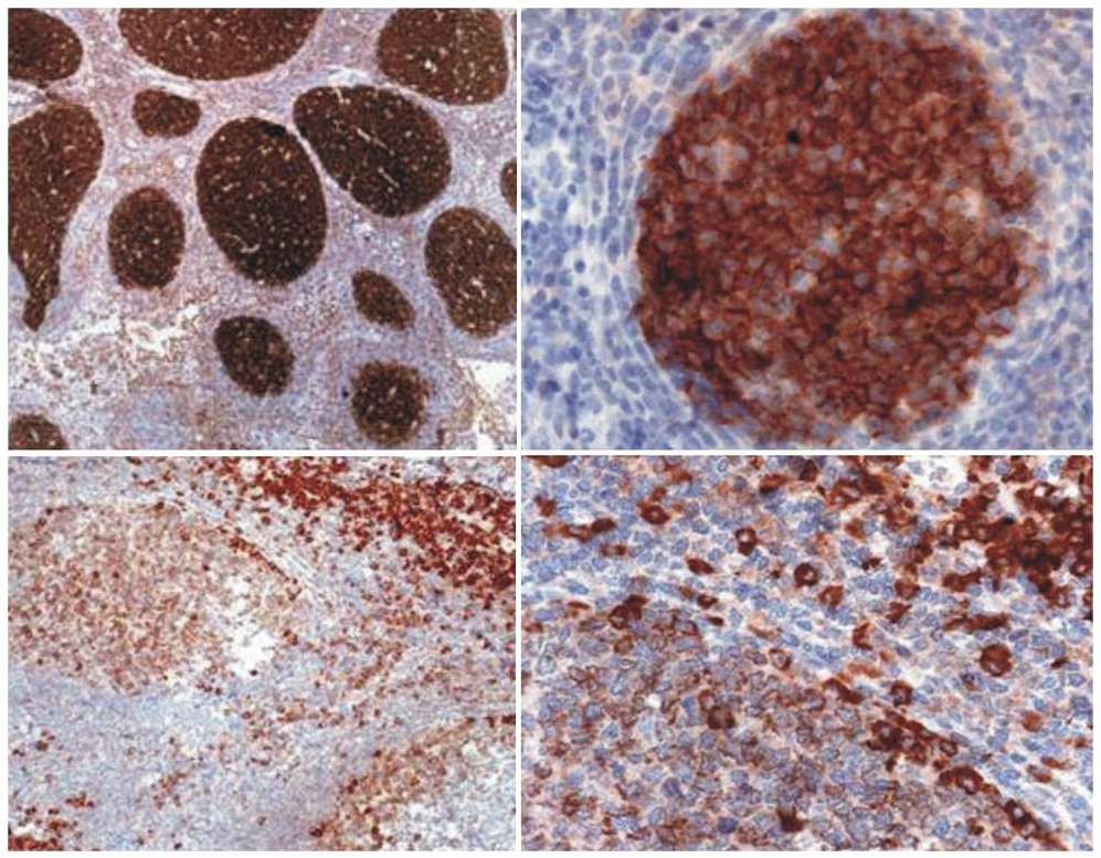 PAG1 Antibody