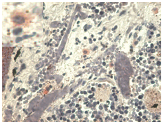 HLA-G Antibody