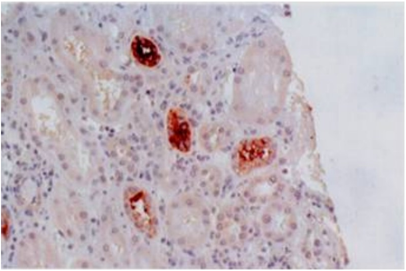 HLA-G Antibody