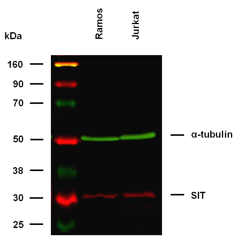 SIT Antibody