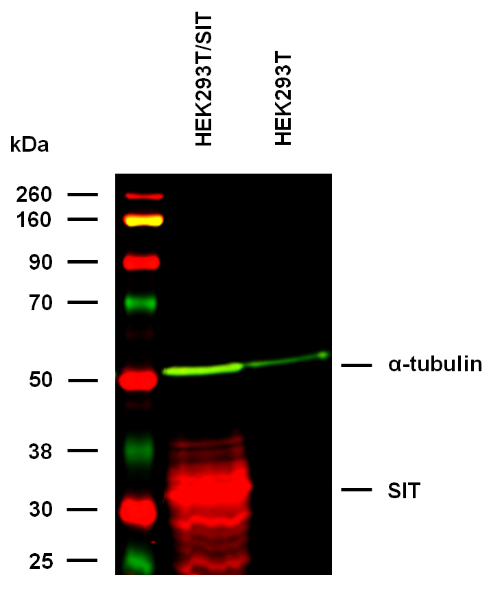 SIT Antibody