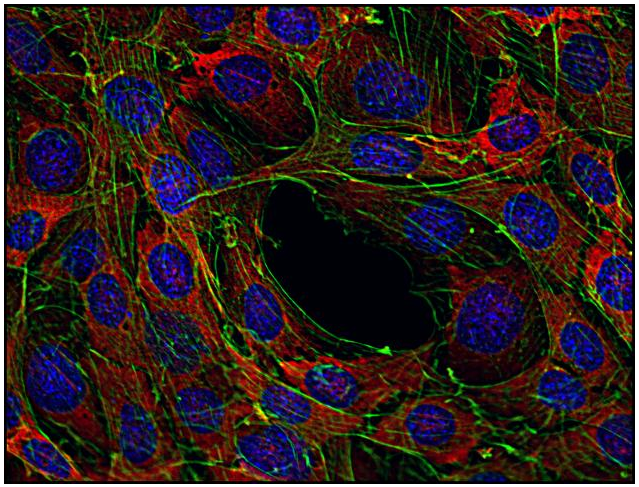 SOS Antibody