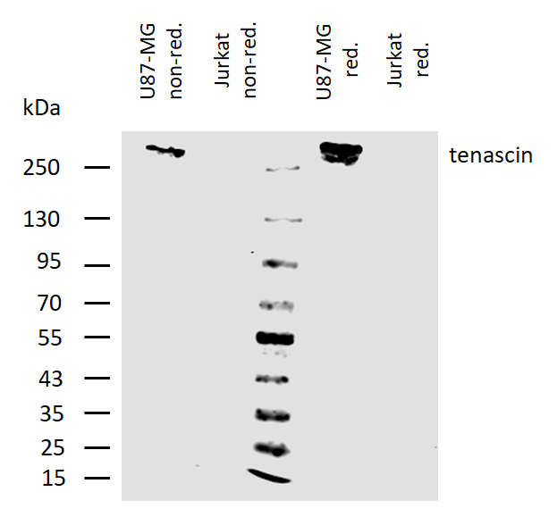 Tenascin C Antibody