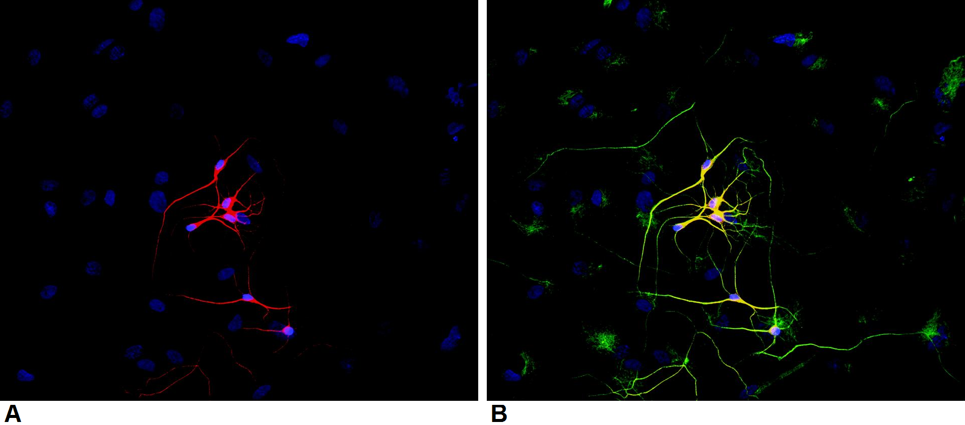 betaIII-Tubulin Antibody