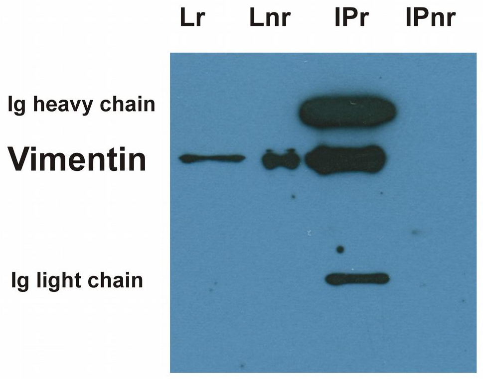 Vimentin Antibody