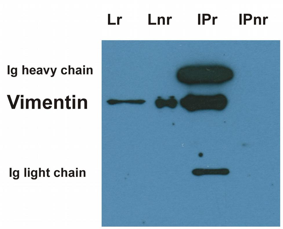 Vimentin Antibody
