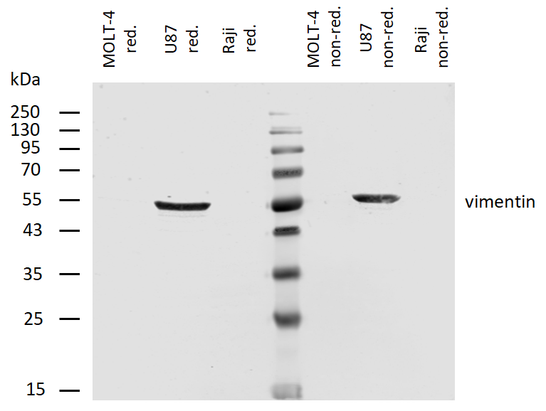 Vimentin Antibody