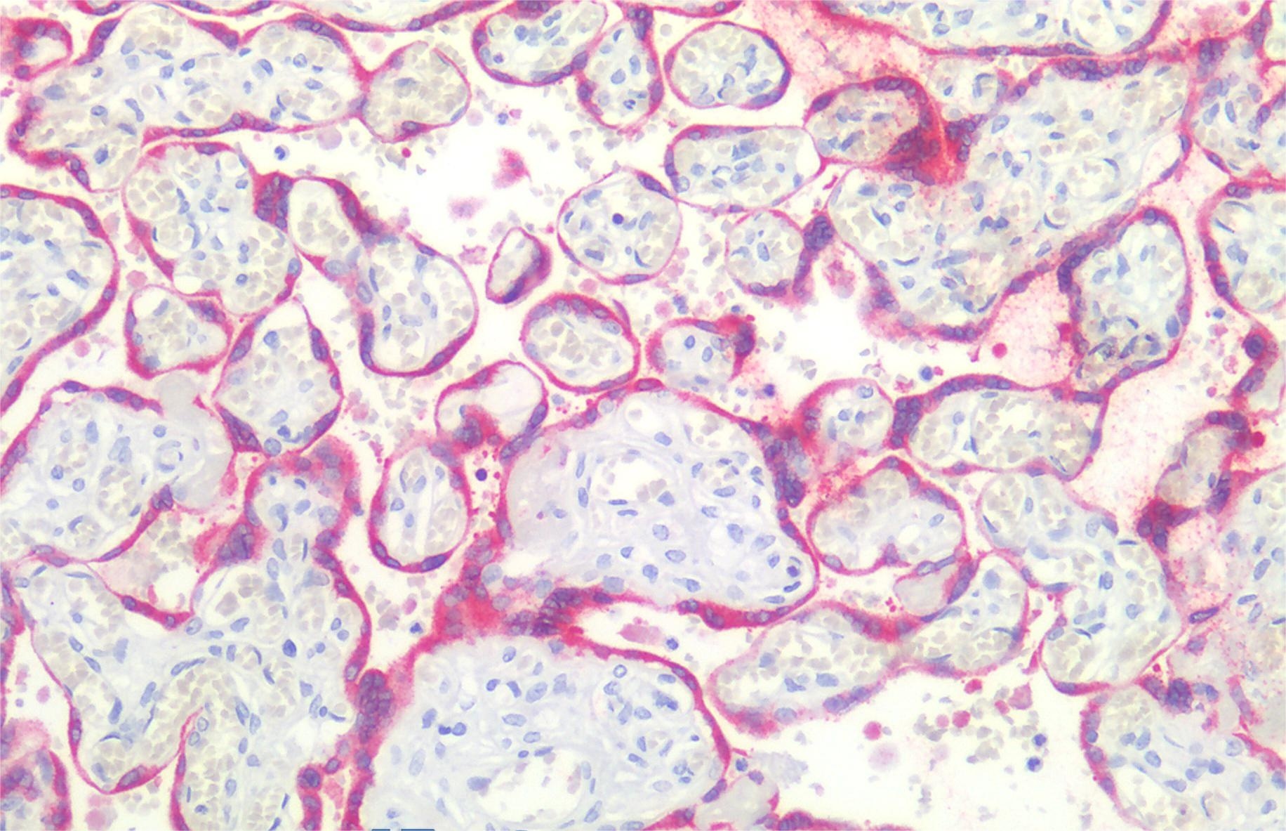 BCL2 Antibody