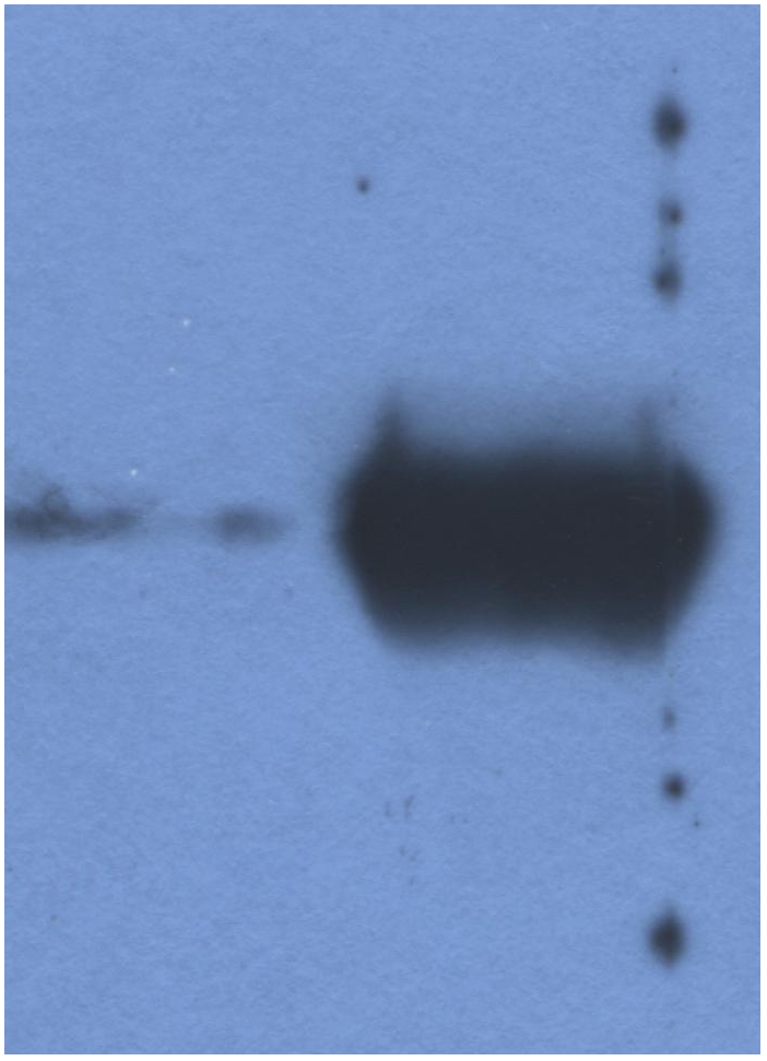 Ig Light Chains Antibody