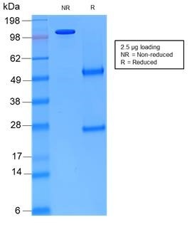 Recombinant mouse vimentin Antibody