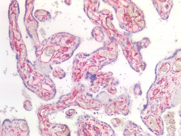 Recombinant rabbit vimentin Antibody