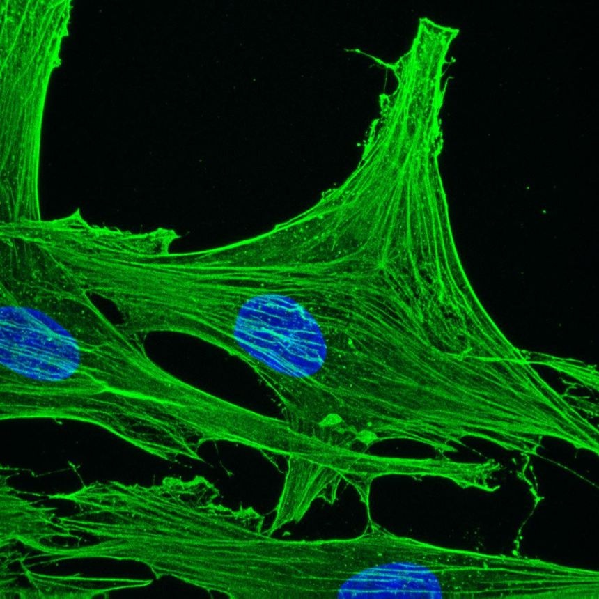 Mouse actin gamma-cytoplasmic Antibody