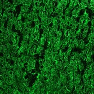 Mouse Cytokeratin 18 / Keratin K18 Antibody