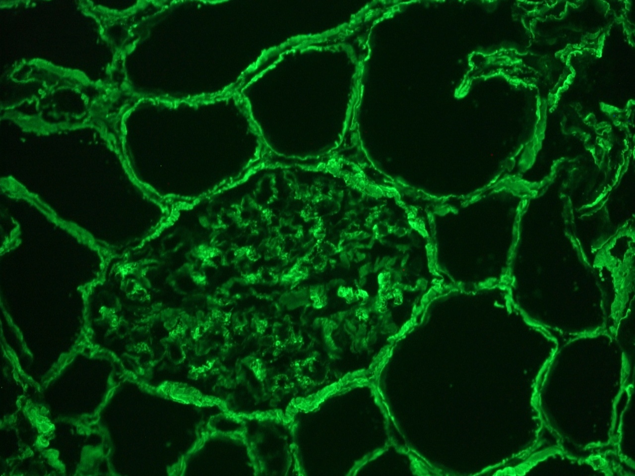 Rabbit Collagen IV Antibody
