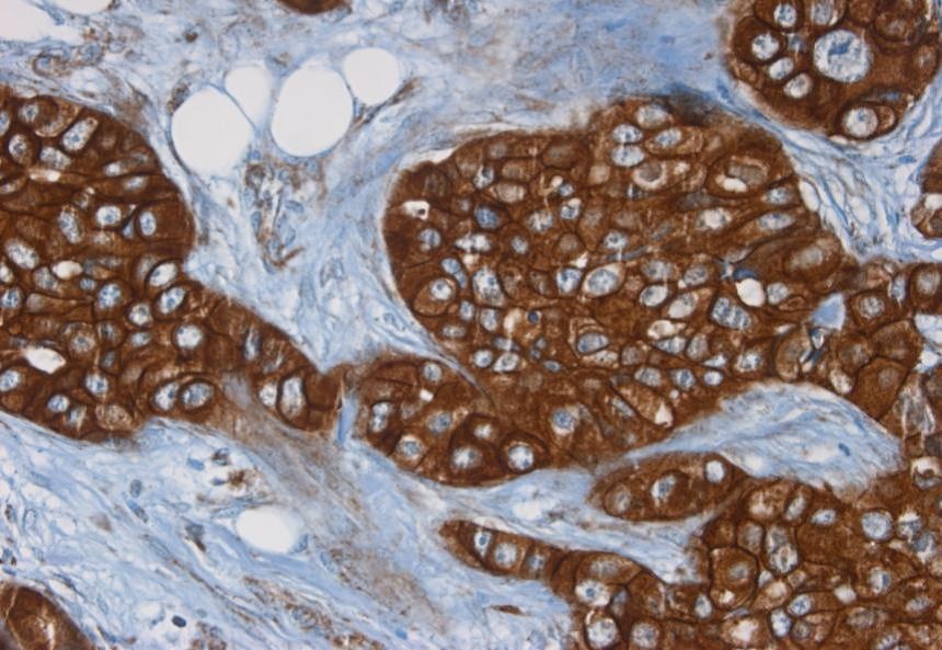 Mouse Neu-Oncogen (C-erb B2) Antibody