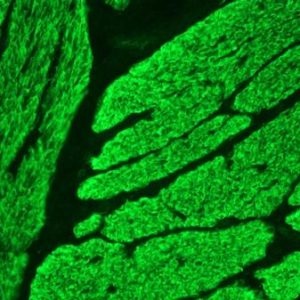 Mouse Smoothelin Antibody