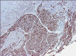 Mouse Smoothelin Antibody