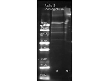 A2M Antibody (HRP)