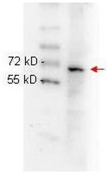 NFkB p65 Antibody