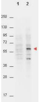 AKT1 Antibody