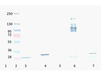 RFP Antibody