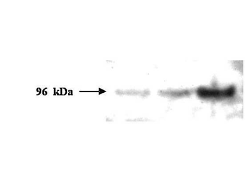 PMS2 Antibody
