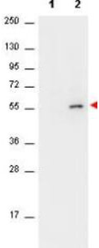 AKT phospho S473 Antibody