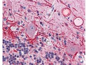 AKT1 Antibody