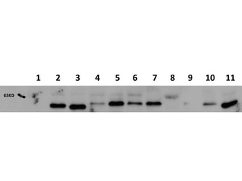 AKT1 Antibody