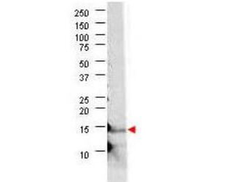 IL-21 Antibody
